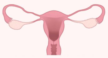 Fisioterapia per la vestibolite vulvare
