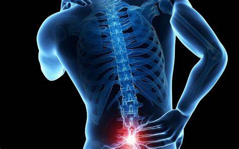 Come curare il mal di schiena lombare con la tecarterapia